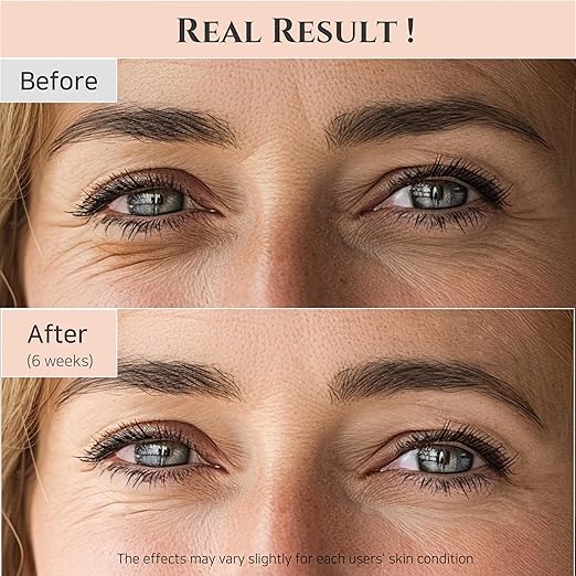 Beauty of Joseon Revive Eye Serum: Ginseng + Retinal
