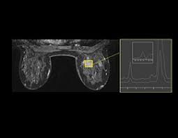 Import Brease M7000EH for Magnetic Resonance Imaging System