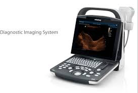 Import DP-20 Portable Diagnostic Ultrasound System with Dual Transducer Connectors