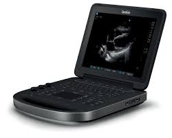 Import EDGE II Ultrasound System with W-Nine Transducer & Triple Transducer Connect