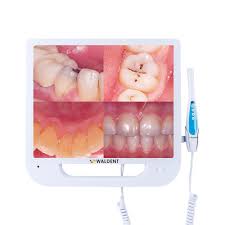 Import Dental USB Camera with High-Resolution Imaging and LED Lights