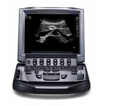 Import M-Turbo Ultrasound System with 12 Transducer Access - Color Doppler