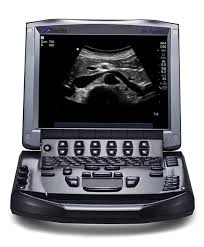 Import M-Turbo Ultrasound System with Transducer - India Model
