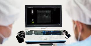 Import Portable Ultrasound Diagnostic System with S1-6P Probe - VINNO 6