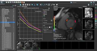 Import T2 Mapping Module for MRI System M3335KY