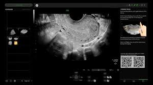 Import Uterine Trace for Color Doppler Ultrasound Scanner - Model H43292LE
