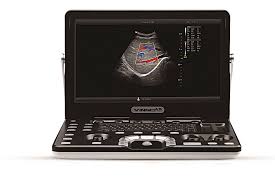 VINNO A5 Ultrasound with A4-9E Probe