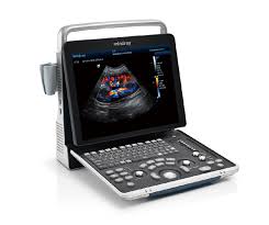 Veterinary Diagnostic Ultrasound System Z60