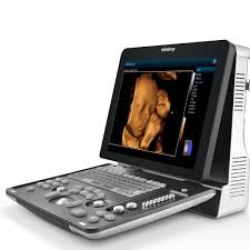Import Z60 Diagnostic Ultrasound System with DICOM Basic for Medical Use