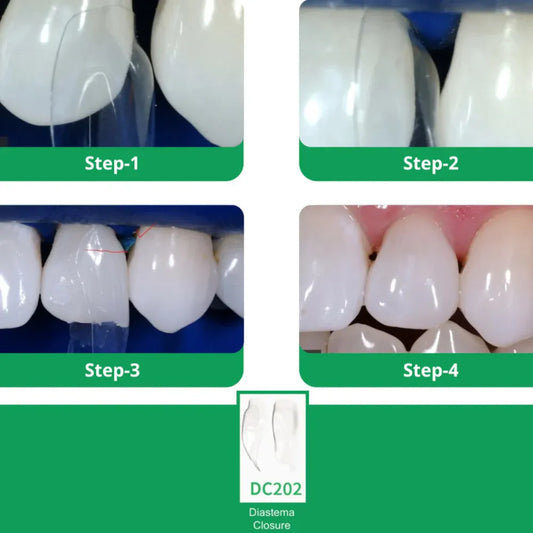 Import Tower Archs Dental Appliance: Precision Tool for Professionals